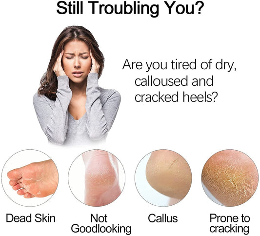 Electric Foot Vacuum Exfoliating Dead Skin Callus Remover